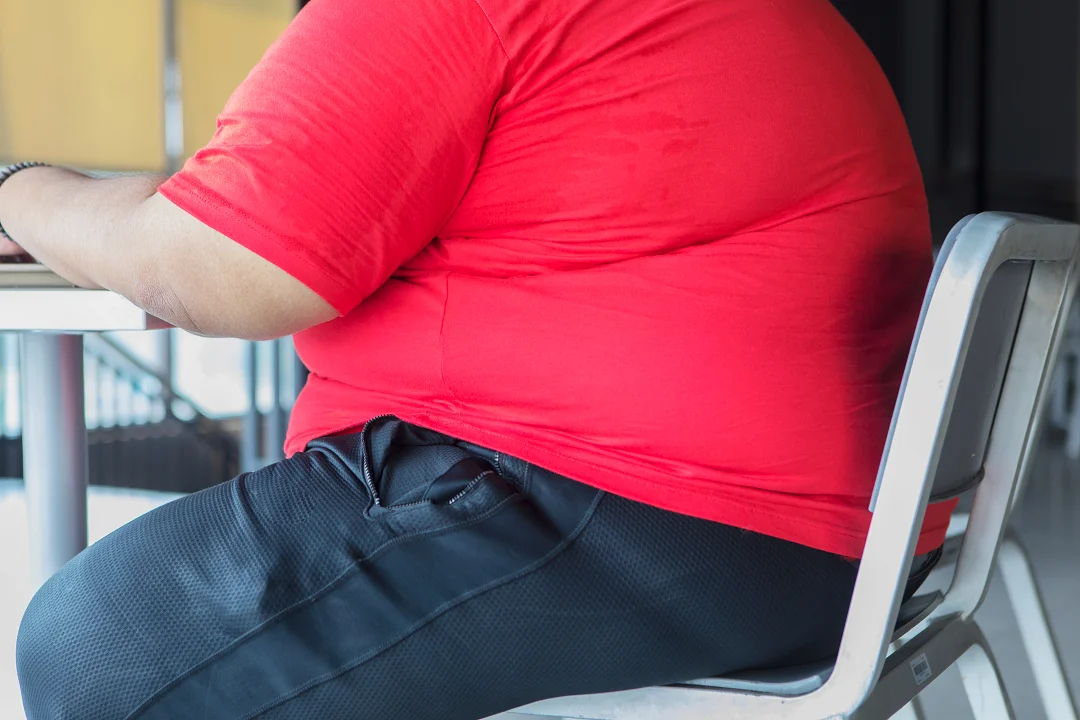 Insurans hayat untuk individu overweight